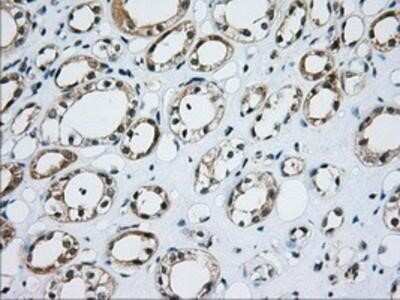 Immunohistochemistry-Paraffin: CD5 Antibody (OTI7A7) [NBP2-02690]