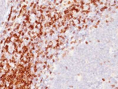 Immunohistochemistry-Paraffin: CD5 Antibody (SPM546) - Azide and BSA Free [NBP2-34788]