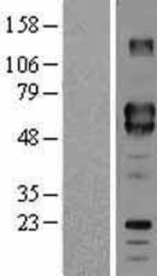 Western Blot: CD5 Overexpression Lysate [NBL1-08956]