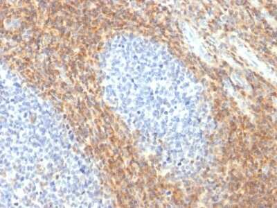 Immunohistochemistry-Paraffin: CD52 Antibody (CD52/2276R) - Azide and BSA Free [NBP3-08642]