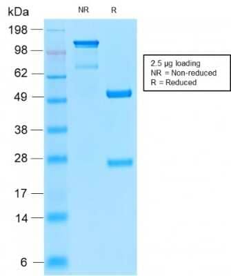 Immunohistochemistry-Paraffin: CD52 Antibody (CD52/2276R) [NBP3-07424]