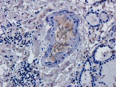 Immunohistochemistry: CD52 Antibody (Campath-1H) - Chimeric - Azide and BSA Free [NBP2-52645]