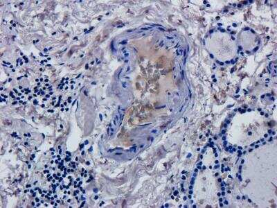 Immunohistochemistry: CD52 Antibody (Campath-1H) - Azide and BSA Free [NBP2-75896]