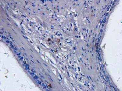Immunohistochemistry: CD52 Antibody (Campath-1H) - Azide and BSA Free [NBP2-75896]