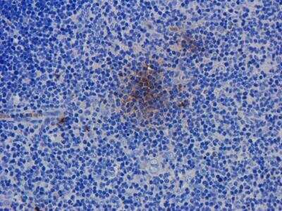 Immunohistochemistry: CD52 Antibody (Campath-1H) - Azide and BSA Free [NBP2-75896]