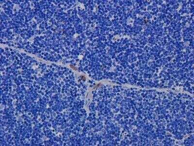 Immunohistochemistry: CD52 Antibody (Campath-1H) - Azide and BSA Free [NBP2-75896]