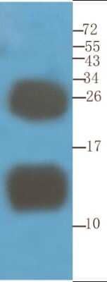 Western Blot: CD52 Antibody (YTH 34.5-G2b (Campath-1G))ChimericAzide and BSA Free [NBP2-52657]