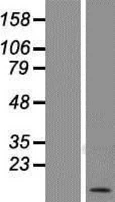 Western Blot: CD52 Overexpression Lysate [NBP2-08175]