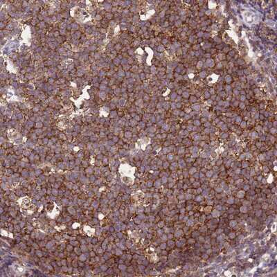 Immunohistochemistry-Paraffin: CD53 Antibody [NBP2-14464]