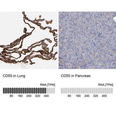 Immunohistochemistry-Paraffin: CD55/DAF Antibody [NBP1-85467]