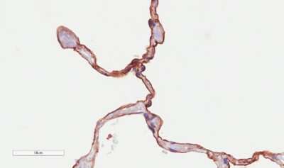 Immunohistochemistry: CD55/DAF Antibody (LU30) - Chimeric - Azide and BSA Free [NBP2-62562]