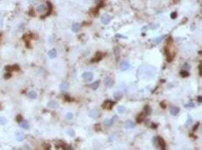 Immunohistochemistry-Paraffin: CD57 Antibody (SPM129) [NBP2-44353]