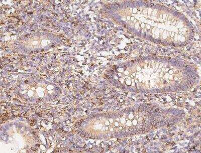 Immunohistochemistry-Paraffin: CD58/LFA-3 Antibody (126) [NBP2-90097]