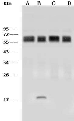 Western Blot: CD58/LFA-3 Antibody (186) [NBP2-90099]