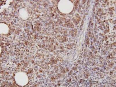 Immunohistochemistry-Paraffin: CD58/LFA-3 Antibody (2D11-B10) [H00000965-M01]