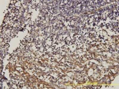 Immunohistochemistry-Paraffin: CD58/LFA-3 Antibody (2D11-B10) [H00000965-M01]