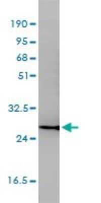 Western Blot: CD58/LFA-3 Antibody (2D11-B10) [H00000965-M01]