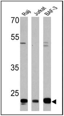 Western Blot: CD58/LFA-3 Antibody (TS2/9)Azide and BSA Free [NBP2-22542]