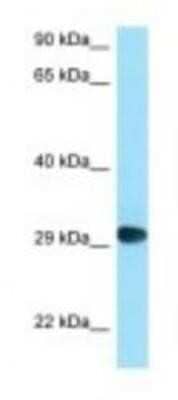 Western Blot: CD58/LFA-3 Antibody [NBP1-98401]