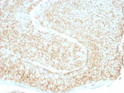 Immunohistochemistry-Paraffin: CD59 Antibody (193-27) - Azide and BSA Free [NBP3-11474]