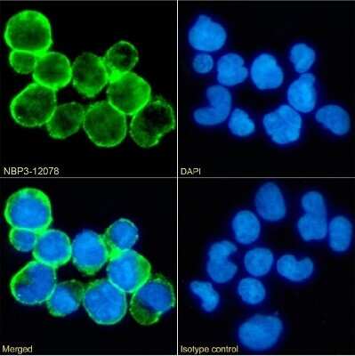 Immunocytochemistry/ Immunofluorescence: CD59 Antibody (193-27) - Chimeric - Azide and BSA Free [NBP3-12078]