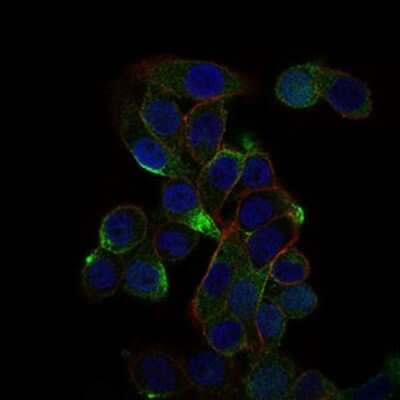 Immunocytochemistry/ Immunofluorescence: CD59 Antibody (8D2B8) - BSA Free [NBP2-37436]