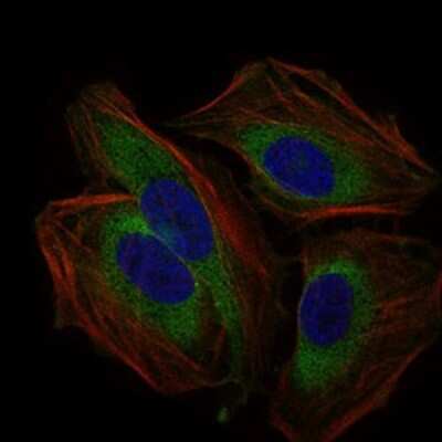 Immunocytochemistry/ Immunofluorescence: CD59 Antibody (8D2B8) - BSA Free [NBP2-37436]