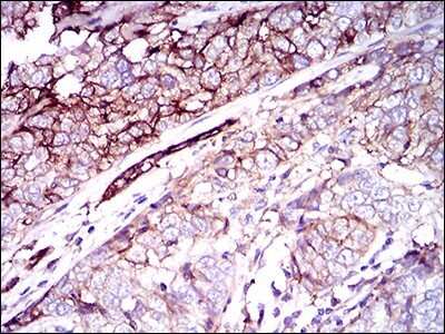 Immunohistochemistry: CD59 Antibody (8D2B8) - BSA Free [NBP2-37436]