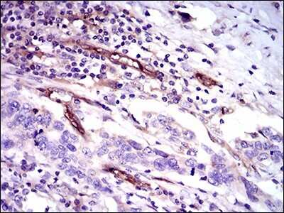 Immunohistochemistry: CD59 Antibody (8D2B8) - BSA Free [NBP2-37436]