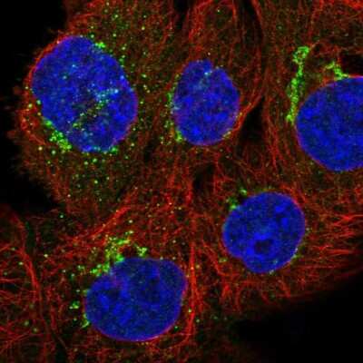Immunocytochemistry/ Immunofluorescence: CD59 Antibody [NBP1-89405]