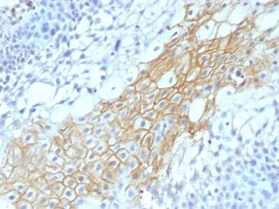 Immunohistochemistry-Paraffin: CD59 Antibody (MACIF/1193) - Azide and BSA Free [NBP2-47822]