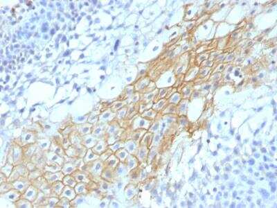 Immunohistochemistry-Paraffin: CD59 Antibody (MACIF/1193) - IHC-Prediluted [NBP2-48467]