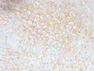 Immunohistochemistry-Paraffin: CD59 Antibody (MACIF/629) - Azide and BSA Free [NBP2-47820]