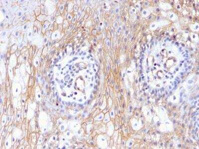 Immunohistochemistry-Paraffin: CD59 Antibody (MACIF/629) - IHC-Prediluted [NBP2-48466]