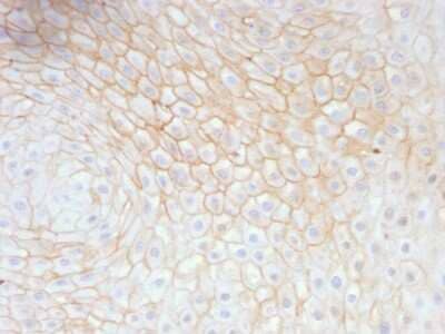 Immunohistochemistry-Paraffin: CD59 Antibody (MACIF/629) [NBP2-44700]