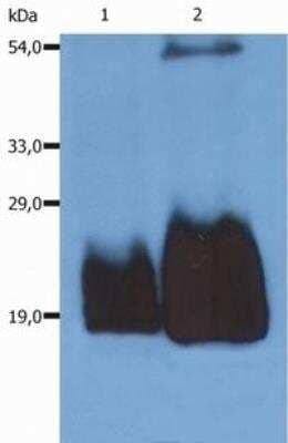 Western Blot: CD59 Antibody (MEM-43/5)BSA Free [NB500-400]