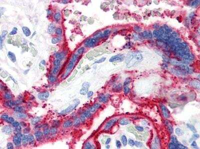 Immunohistochemistry-Paraffin: CD59 Antibody (MEM-43) - BSA Free [NB500-330]