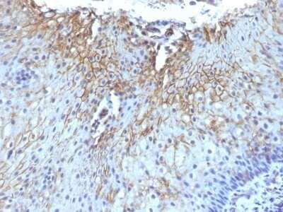 Immunohistochemistry-Paraffin: CD59 Antibody (SPM616) - Azide and BSA Free [NBP2-47821]