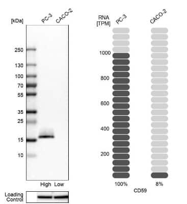 Western Blot: CD59 Antibody [NBP1-89405]