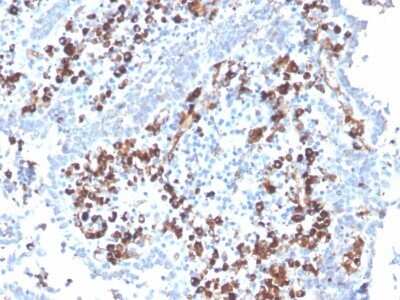 Immunohistochemistry-Paraffin: CD5L Antibody (CD5L/2991) - Azide and BSA Free [NBP2-79841]