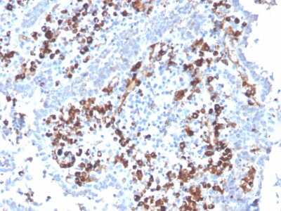 Immunohistochemistry-Paraffin: CD5L Antibody (CD5L/2991) [NBP2-79707]