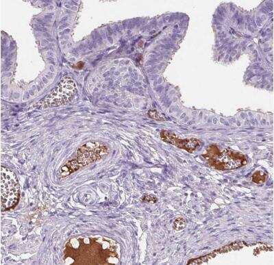 Immunohistochemistry-Paraffin: CD5L Antibody [NBP2-39061]