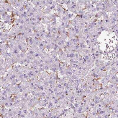Immunohistochemistry-Paraffin: CD5L Antibody [NBP2-39061]