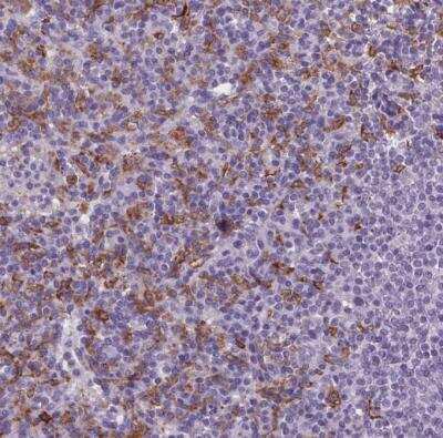 Immunohistochemistry-Paraffin: CD5L Antibody [NBP2-39061]