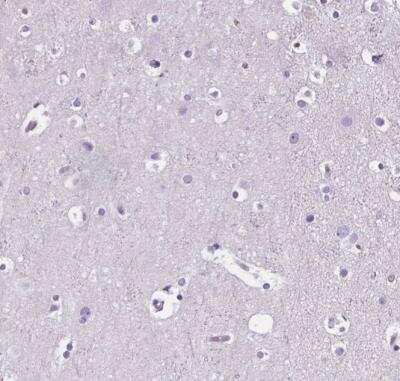 Immunohistochemistry-Paraffin: CD5L Antibody [NBP2-39061]