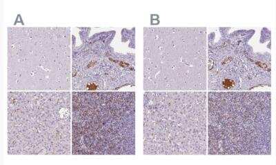 Immunohistochemistry-Paraffin: CD5L Antibody [NBP2-39061]