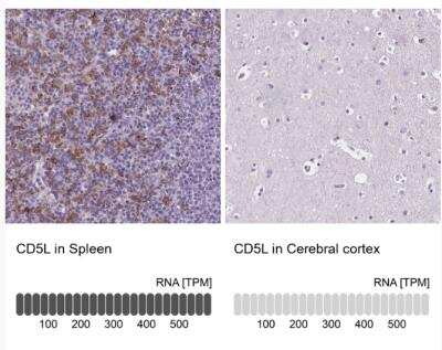 Immunohistochemistry-Paraffin: CD5L Antibody [NBP2-39061]