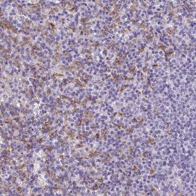 Immunohistochemistry-Paraffin: CD5L Antibody [NBP2-39094]
