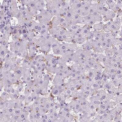 Immunohistochemistry-Paraffin: CD5L Antibody [NBP2-39094]