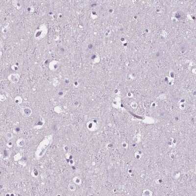 Immunohistochemistry-Paraffin: CD5L Antibody [NBP2-39094]